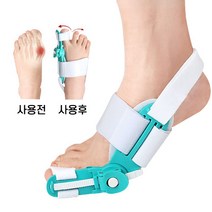 발가락 교정기 무지외반증교정기 엄지손가락교정기, 그레이, 1개