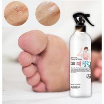 발바닥껍질벗겨짐 각질용해제 발뒤꿈치 발바닥각질 무좀 뿌리는 때비누 피지 녹이는제품