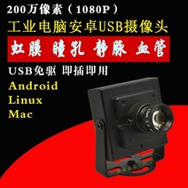 열화상 카메라 적외선 안면 인식 열감지카메라 1080p 적외선 인간의 눈 홍채 동공 정맥 혈관 인식 안드로이드 산업용 카메라 왜곡 없음 usb 카메라, led 와이어 제어(표시할 초점 거리 메시지)