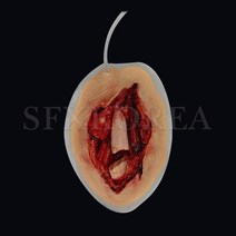 SFX.자가점착 외상피부 병원 경찰 군부대 응급처치 훈련교재 상처치료훈련 시뮬레이션 연습키트, 22.SFX.외상피부_골절(양방 돌출형)
