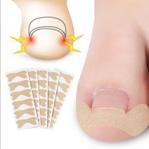 파고드는 내성 발톱 교정 보호 테이프 밴드 30pcs, 내성발톱교정밴드30P