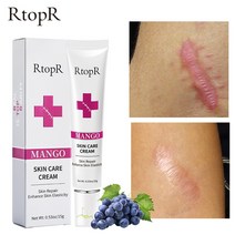 R탑R 흉터 크림 부드럽게 제거 피부 회복 리쥬버네이트 미백 트리트먼트 콜라겐 형성 촉진