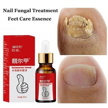 손톱 내성발톱 무좀 곰팡이 연화제 항균 큐티클 오일 에센스 nail fungal treatment feet care nail foot whitening toe nail fungus, 없음