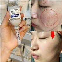 글루타치온 검버섯제거 앰플 또는 보톡크림 또는 재생선크림 중 택1/굵은주름 모공 늘어진피부 리프팅/멜라논크림/얼굴 검버섯/검버섯제거/기미에좋은팩/기미치료/검버섯제거비용, 6세트+원장님 보톡아이크림 1