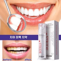 치아 미백 화이트닝 셀프 치아 미백 치약 얼룩제거, 1개, 60ml