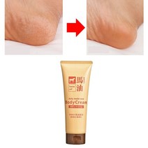 발 뒤꿈치 굳은살 발바닥 제거 갈라짐 연고 발건조 각질 용해제 연화 크림 껍질 벗겨짐, 1개, 1개