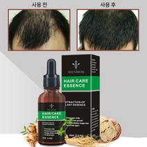 남성 여성 두피 에센스 발모제 강인하고 부드러운 풍성한 모발, 1개, 30ml