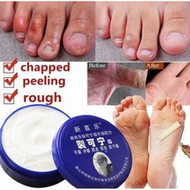 안티 크랙 풋 크림 건조 발 마스크 뒤꿈치 금이 간 복구 핸드 모이 스처 라이징 캘러스 피부 손 피트 케어 33g