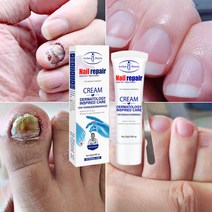 발톱 무좀약 발톱치료 연고 손톱 네일 리페어, 20ml, 2개