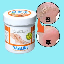 발바닥껍질벗겨짐 발각화증 크림 1개 발각질제거 피지연화제 코 블랙헤드 제거 올리브영 크림 발뒤꿈치 각질연화제