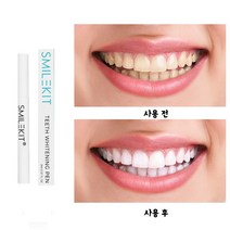 화이트닝 치아미백 스틱 셀프 치아미백겔 신규출신 할인중, 2ml, 5개