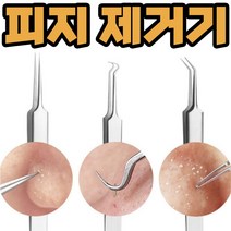 코피지 제거기 얼굴 피지 압출기 블랙헤드 뽑기 압출, 쿠팡꺼 바늘루프형, 쿠팡꺼 본상품선택