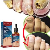 발톱무좀치료 발톱무좀연고 리페어 에센스, 10ml, 2개