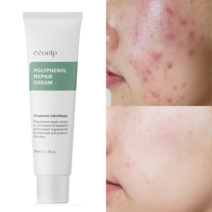꼰닙 시카 리페어 크림 70ml 세라마이드 피부장벽 수분 트러블 케어, 1개