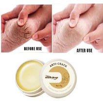 안티 갈라진 발 뒤꿈치 트리트먼트 크림 허브 건조 제거 굳은살 각질 밤 손 보습 리페어 스킨 케어 마스크
