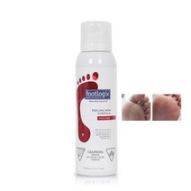 Footlogix 풋로직스 필링 스킨 포뮬라 119.9g Peeling skin formula 뉴패키지, 1개, 1개