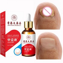 무좀 내성발톱 발톱무좀 새로운 네일 곰팡이 수리 에센스 세럼 트리트먼트 케어 발 제거 젤 안티 감염 손, 한개옵션0