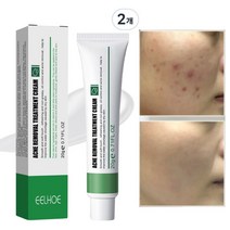 [트러블 극복 2종] 여드름흉터 병풀차 리페어 크림 /트러블 자국/민감피부 개선, 20g, 2개