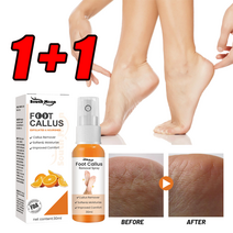 1+1 무좀 발 관리 스프레이 풋 필링 스프레이 60ml, 1개, 2개