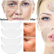 주름 패치 리프팅 기미 제거 스팟 눈밑 눈가 미간 이마 목 아이 팔자 얼굴 실리콘 패치 안티 rimpel 패드 실리콘 주름 제거 스티커 얼굴 이마 목 가슴 눈 스티커 스킨 케어, 4개
