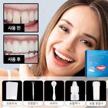 1+1치아미백패치 보철 접착제 세트 인텐시브 치아미백겔 실용적/안전/쉬운 조작, 보철 접착제 세트*4, 1set