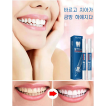 치아미백 젤 치아 누런 때 제거 브라이트닝 젤펜 치아 누런때 제거 (19g*2개/박스)*1/3, 1개