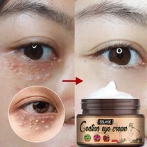 30g 효과적인 지방 제거 아이 크림 아이 백 개선 잔주름 희석 다크 서클 모이스처라이징 퍼밍 아이 케어 세럼, 01. 30g