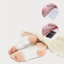독소제거 노폐물제거 풋패치 10매 발바닥 국내생산 발건강 발파스 목초수액시트, 상세페이지 참조, 상세페이지 참조