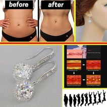 건강귀걸이 다이어트 혈액순환 체중감량 살빠지는 귀걸이 자기 스탈 빠른 슬림, 없음