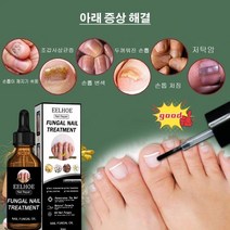 30g 조갑사상균증 진균 리페어에센스조갑사상균증 치료제리페어발톱무좀약