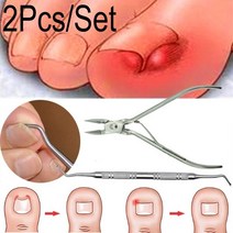 손톱깎기 네일케어자란 발톱 페디큐어 풋 케어 도구 손톱 교정 용 클리퍼 커터 Orthotic Acronyx Dead Skin, 2PCS 세트 A