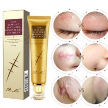 고고윙 흉터제거연고 화상연고 수술흉터 리페어 상처 재생크림, 2개, 30g
