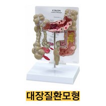 미국/대장모형 대장질환모형 G334/대장의 여러가지 질환을 나타내 주는 모형