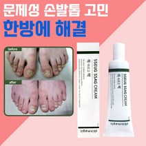 문제성 손발톱 케어 뒤꿈치 갈라짐 두꺼운 발톱 발각질 제거 연화제 치유크림 쓱싹크림 30ml 쓱싹크린풋 발비누 별도 구매 가능, 쓱싹크림 + 쓱싹크린풋 발비누