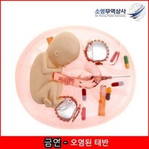 보건교육용품-오염된태반모형 금연교육자료