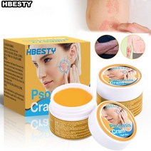 HBESTY 건선 피부건선 피부 발진 피부가려움증 피부 두드러기 트리트먼트 크림 10g