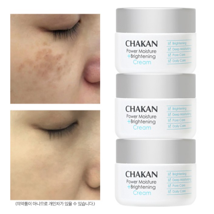 기미 주근깨 미백개선 피부결개선 광채 기미잡티 크림, 3개, 50ml 기미 주근깨 미백개선 피부결개선 광채 기미잡티 크림, 3개, 50ml