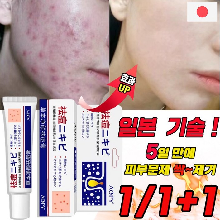국내배송 여드름 연고 흉터 치료 제거 리페어 연고 문제피부 자국 모공 진정 피지케어 크림