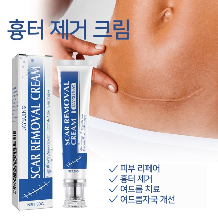 당일발송 / 흉터 체질 구원자 / 새오래된 흉터 / 수술 흉터 / 여드름 자국수술 흉터화상 흉터 한 튜브로 해결WM008