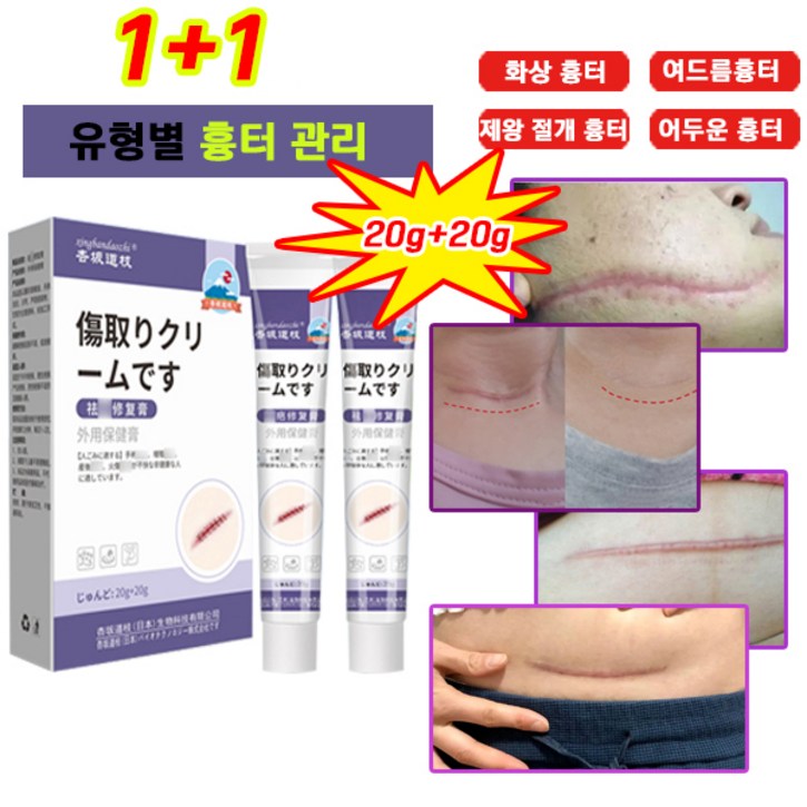 100제거당일배송 흉터제거 상처흉터 여드름 민감한 피부를 수술 화상 제왕절개 수술흉터