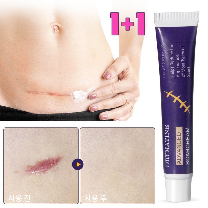 [당일배송] DRYMATINE 흉터연고 흉터제거연고 재생크림 상처흉터연고 여드름흉터 수술흉터 화상물집 흉터제거연고 재생크림 화상연고 흉터연고 연고 상처연고후시딘 상처연고 마일드랩